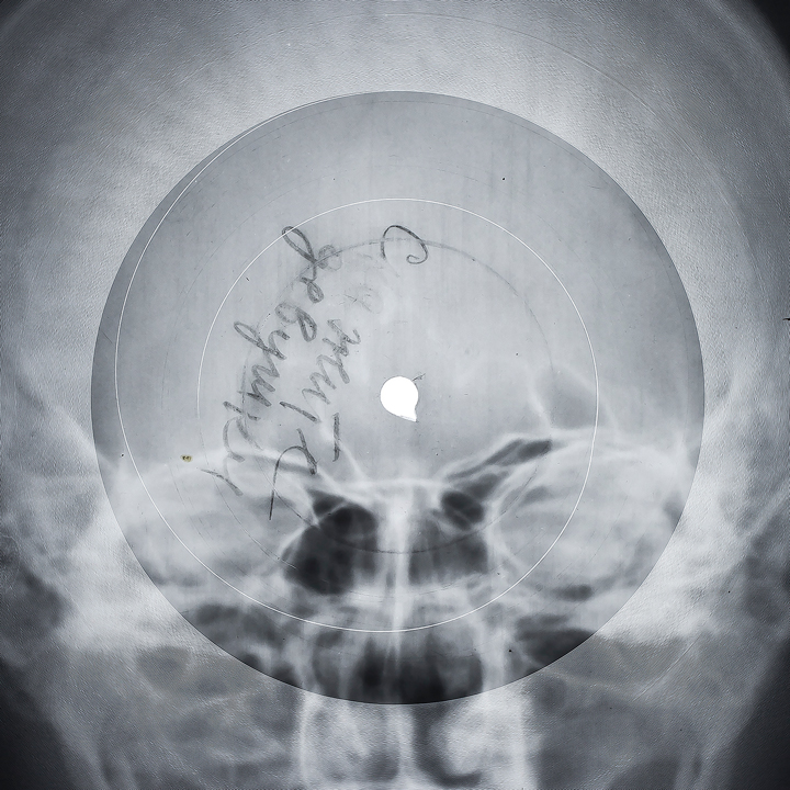 X-ray Records 1946–1964 | Garage