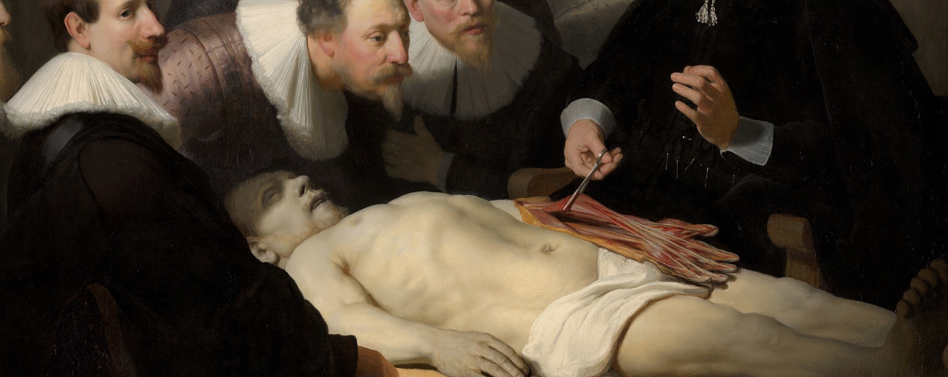 Иллюстрация: Рембрандт. Урок анатомии доктора Тульпа (фрагмент). 1632