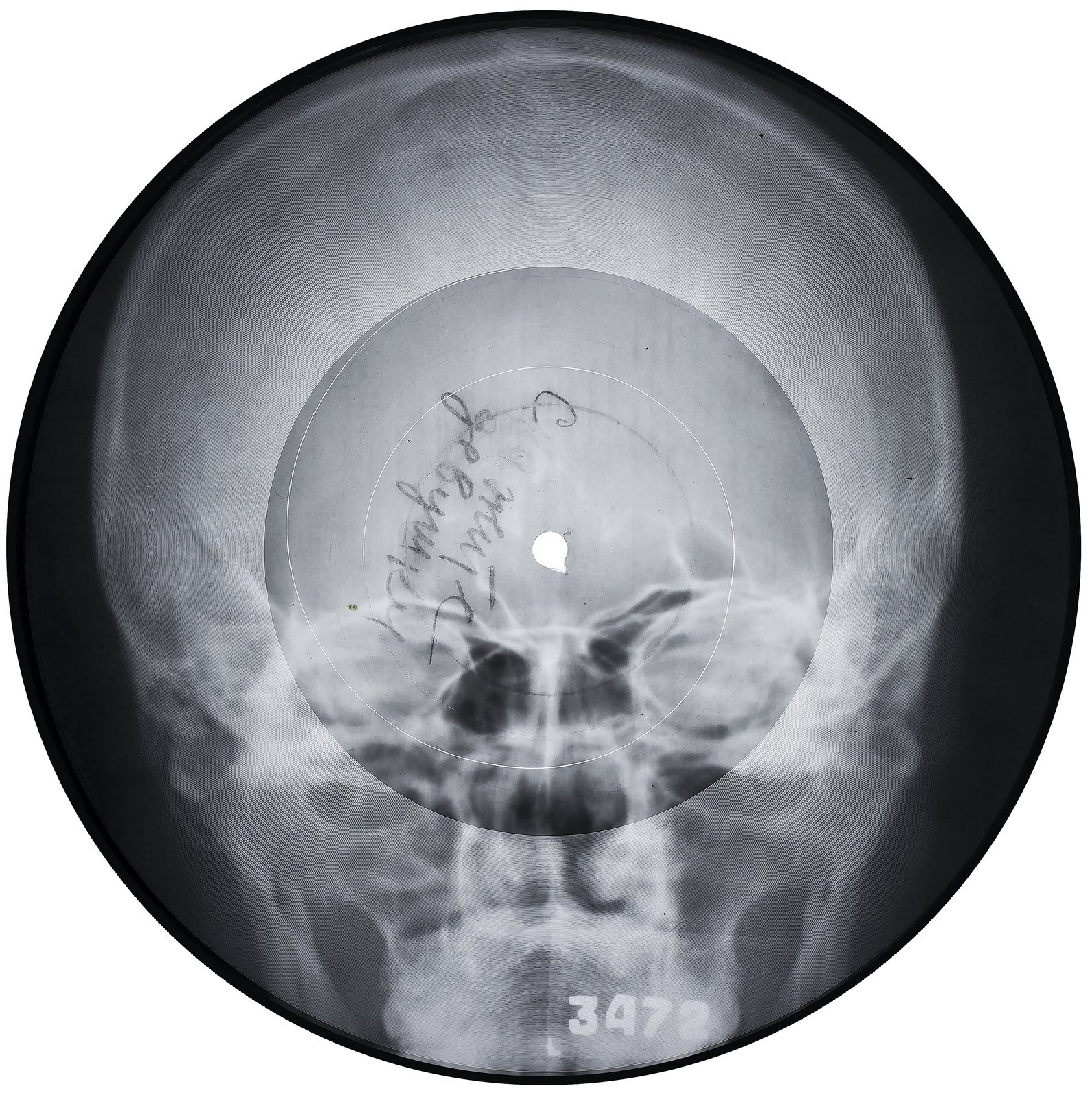 Неизвестный исполнитель, &laquo;Скажите девушки&raquo;. Конец 1950-х &mdash; начало 1960-хАудиозапись на рентгеновском снимке. Диаметр 22 смСобрание X-Ray Audio, Лондон