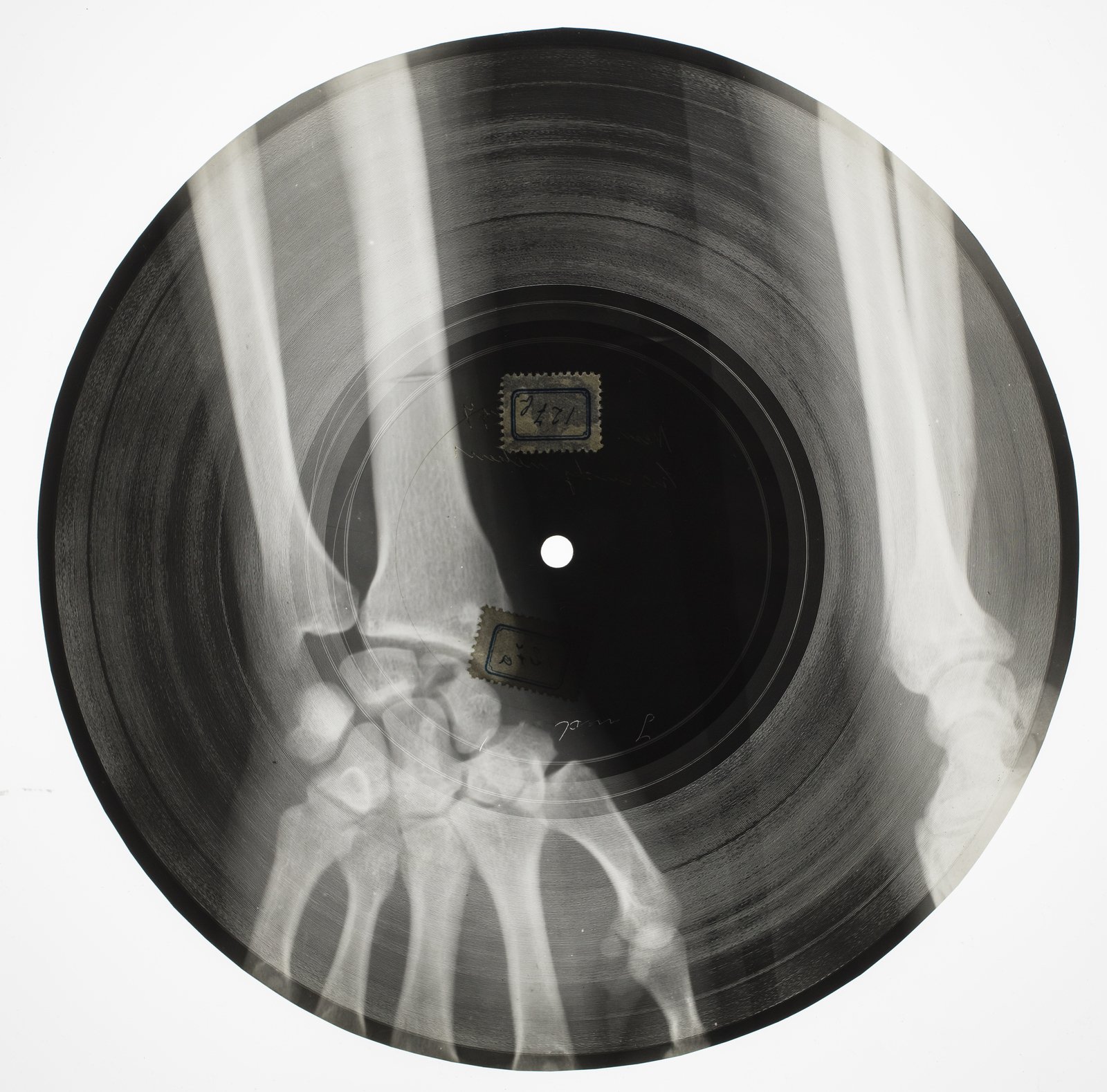 Unknown home recording, Budapest, late 1930s&ndash; early 1940sLathe-/hand-cut record on x-ray film, 22cm diameterCollection of Janos Sebasteyn / National Sz&eacute;ch&eacute;nyi LibraryСourtesy X-Ray Audio, London